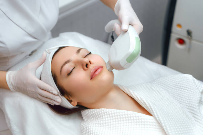 IPL Acne Management