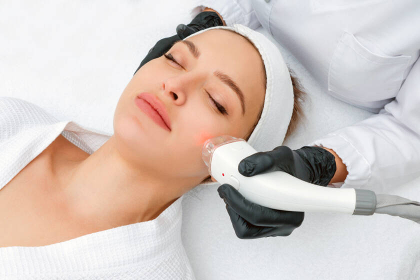 IPL hair removal treatments